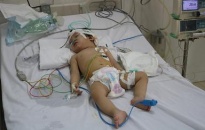 Bệnh viện Trẻ em Hải Phòng: Cứu sống trẻ 13 tháng tuổi bị dập não, vỡ xương sọ do tivi rơi vào đầu  