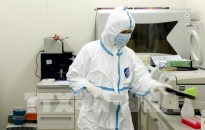 Nhiều quốc gia trên thế giới đặt hàng Việt Nam sản xuất bộ kít xét nghiệm vius SARS-CoV-2