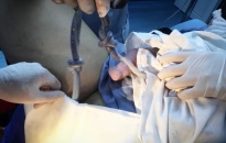 BV Đa khoa quốc tế đón bé gái bị dây rau thắt nút 2 vòng chào đời bằng phương pháp sinh thường