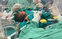 Bệnh viện Trẻ em Hải Phòng: Thay máu toàn phần cho trẻ vàng da sơ sinh nặng mới 3 ngày tuổi