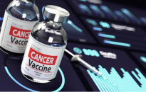 Vaccine ung thư của Moderna - Merck giúp giảm nguy cơ khối u ác di căn