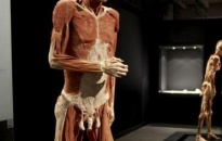 Pháp cấm triển lãm về xác người