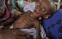 Somalia đói thê thảm!